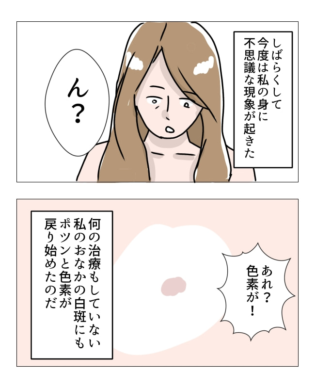 娘の尋常性白斑／フワリー