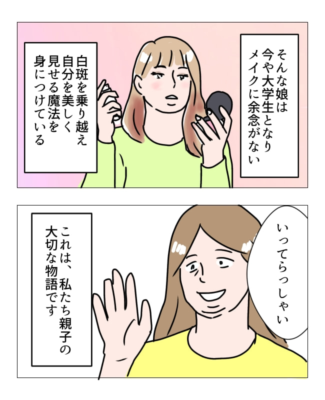 娘の尋常性白斑／フワリー