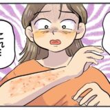 40代、目覚めると赤いボツボツがびっしり！？医師から告げられたまさかの診断【体験談】