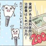 「なぜ欠けたの！？」200万円かけたインプラントが破損。歯科医から告げられた予想外の原因