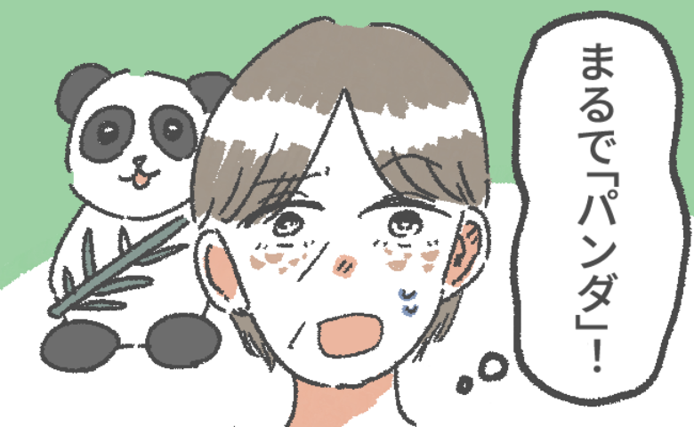 肝斑ができた女性