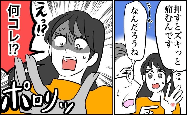 手のしこりが気になっていた女性