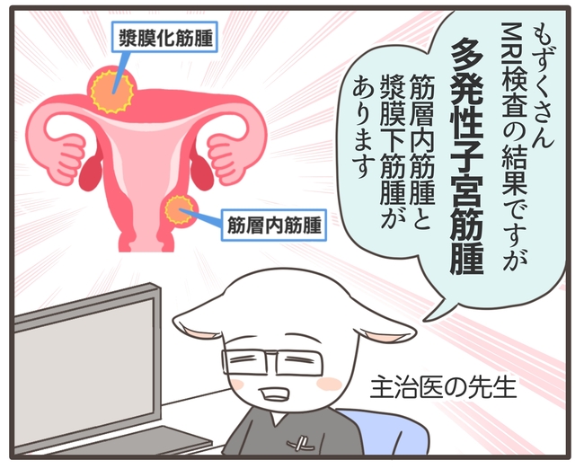 アラフィフが子宮全摘/宮島もっちー