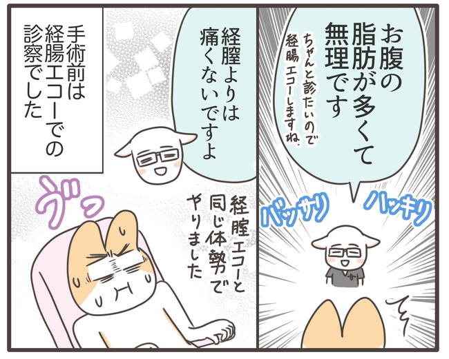 アラフィフが子宮全摘／宮島もっちー