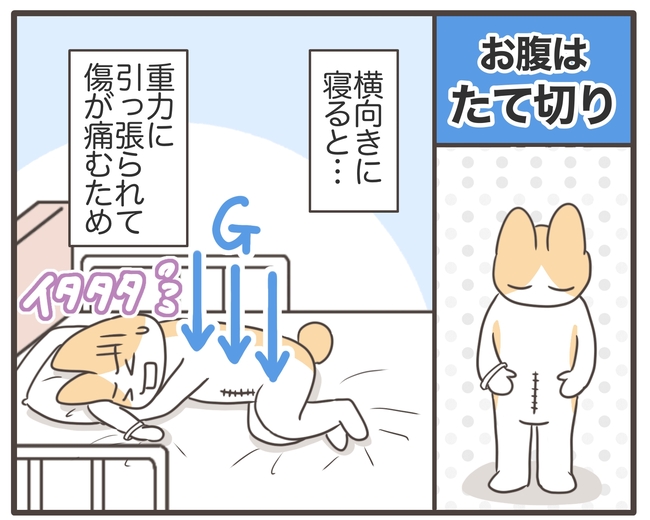 アラフィフが子宮全摘/宮島もっちー