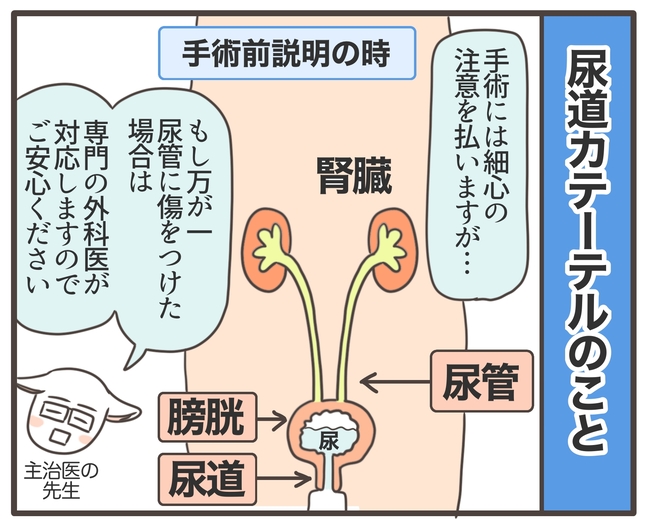 アラフィフが子宮全摘/宮島もっちー