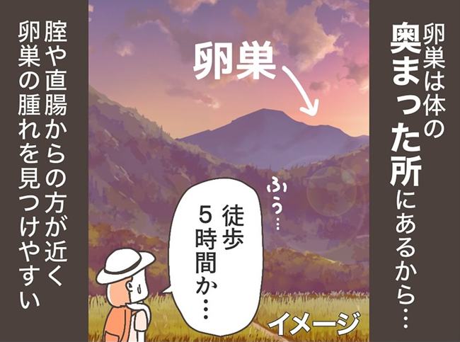 子宮全摘後のリアル／宮島もっちー