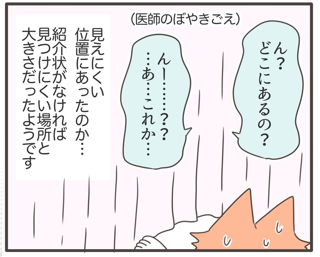 貧血放置で子宮筋腫手術／宮島もっちー