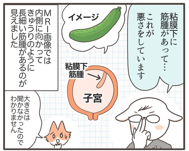 貧血放置で子宮筋腫手術／宮島もっちー