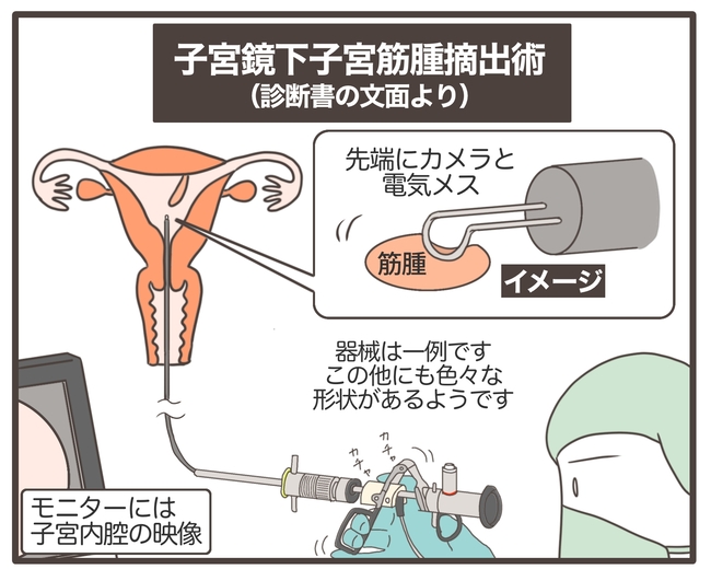 貧血放置で子宮筋腫手術／宮島もっちー