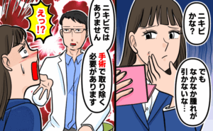 頬のニキビがなかなか治らず「ただのニキビかな？」と気にしていた女性。次のコマで医師から「ニキビではありません。手術で取り除く必要があります」と告げられ、「えっ!?」と衝撃を受ける