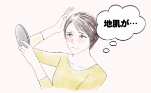 「地肌が…薄毛かも？」美容師に教えてもらった、頭皮が気になる私の対策【体験談】