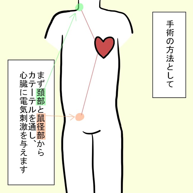 27歳第2子妊娠中に不整脈／萩原さとこ