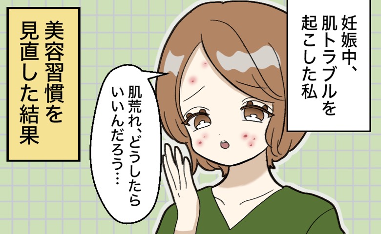 妊娠中の肌トラブルに「どうしたらいいんだろう」と悩む女性の様子。吹き出しには「美容習慣を見直した結果」とある。