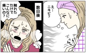 「ニキビかな…」胸の横にできた小さな膨らみを放置した結果、医師から告げられた病名とは【体験談】