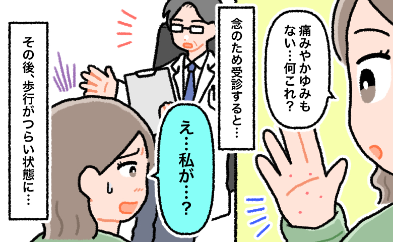 手足に痛みやかゆみのない発疹が出た女性が手を見て不思議に思い、受診後に医師から説明を受けて「え…私が？」と驚く様子と、その後歩行がつらくなったことが示されている場面。