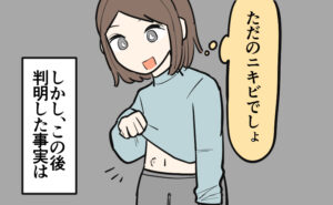 おなかのできものを見て「ただのニキビでしょ」と軽く考えている女性と、「しかし、この後判明した事実は」と示されている場面。