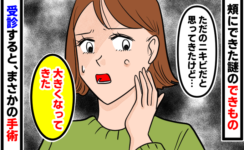 頬のできものを「ただのニキビだと思ってきたけど…」「大きくなってきた」と不安そうに触る女性のイラスト