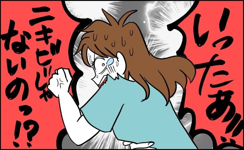 粉瘤が痛い女性
