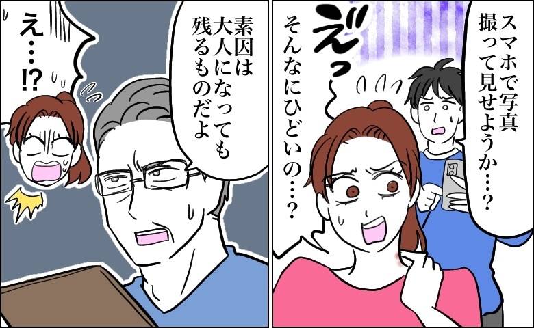 首元に赤みが出た女性