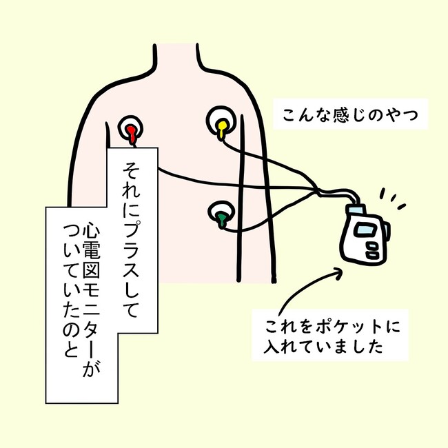 27歳第2子妊娠中に不整脈／萩原さとこ
