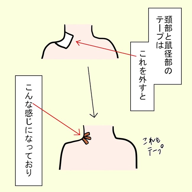 27歳第2子妊娠中に不整脈／萩原さとこ