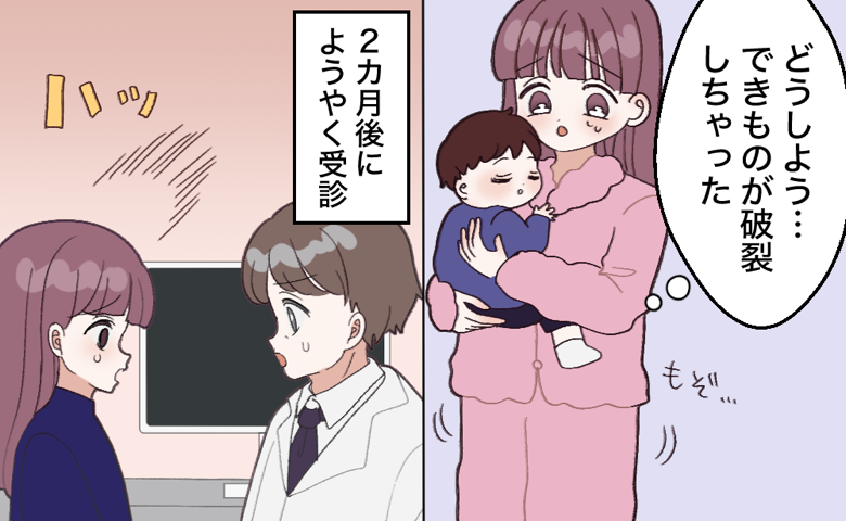 赤ちゃんを抱えた女性が「できものが破裂しちゃった」と不安そうにしている場面と、2カ月後に受診し医師と向き合う様子。
