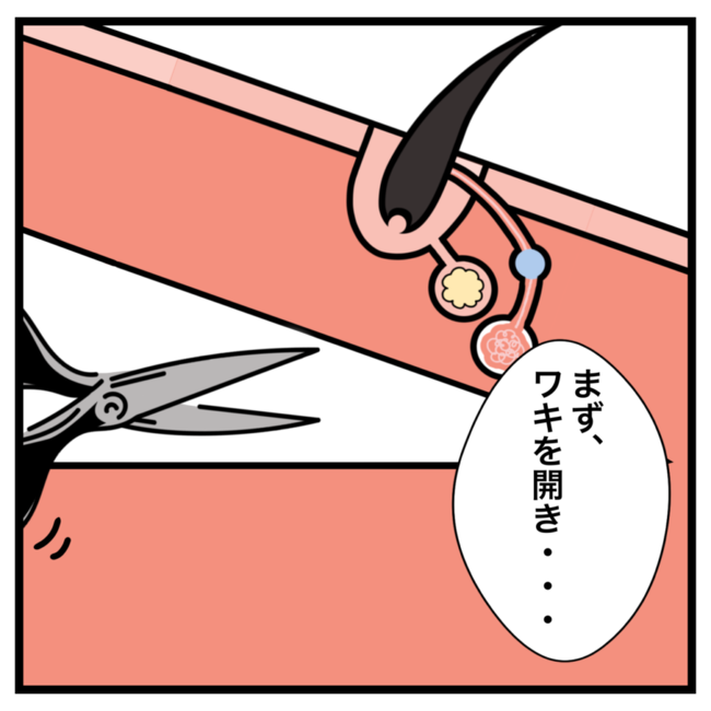 ワキガ治療で搬送された話／すがのみさき