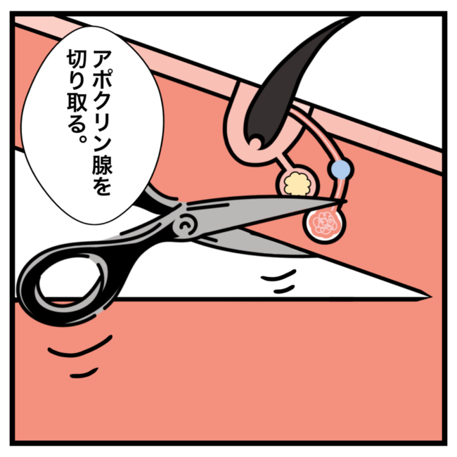 ワキガ治療で搬送された話／すがのみさき