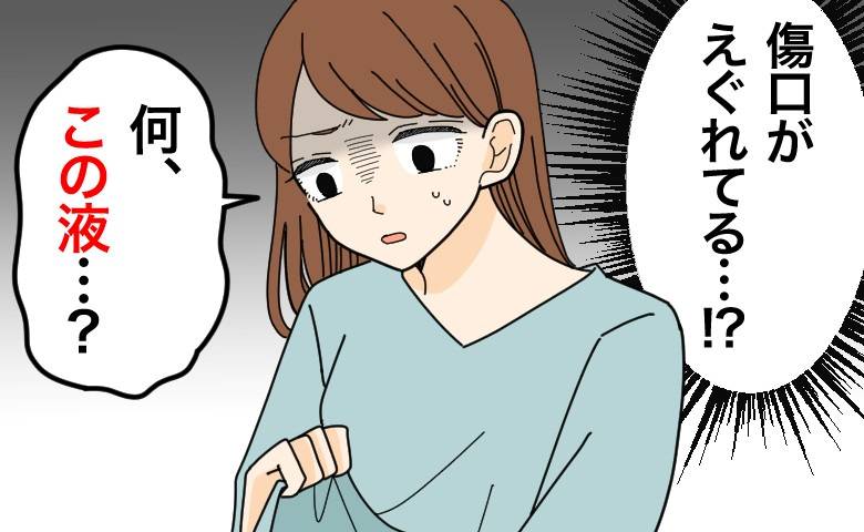 帝王切開の傷痕に謎の液が出た女性