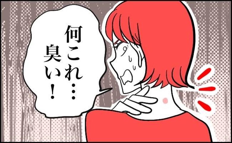 粉瘤　イメージカット