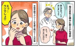 シェーグレン症候群の女性