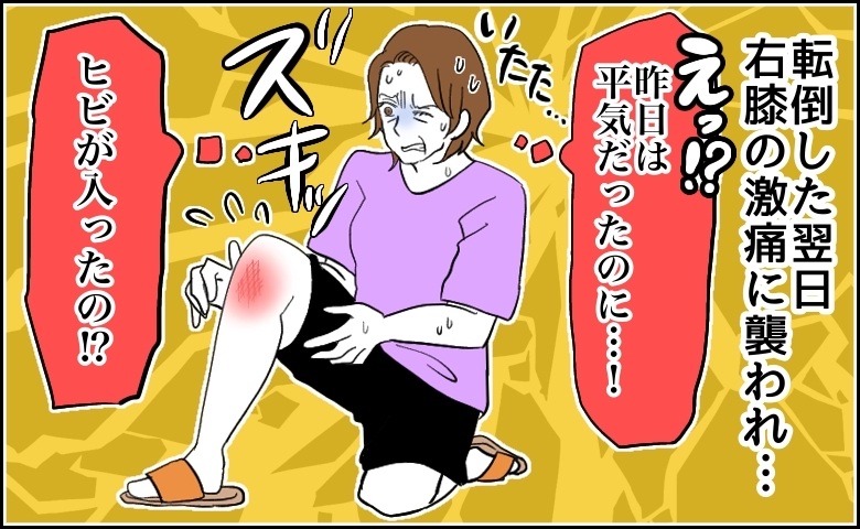転倒した翌日、右膝の激痛に襲われる女性