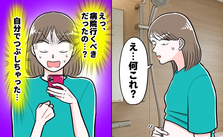 おなかにできた吹き出物に気付く女性