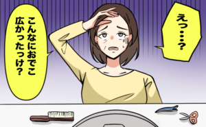 おでこの広さが気になる40代の女性
