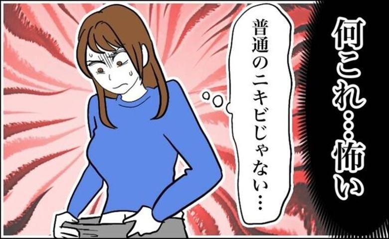 粉瘤　イメージカット