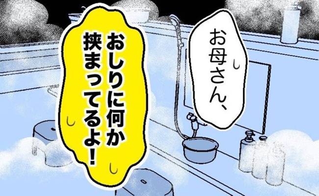 子宮脱体験談 イメージカット