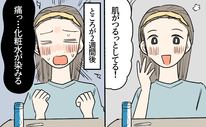 ヘアバンドをした女性が頬に手を当て「肌がつるっとしてる！」と嬉しそうに微笑んでいる。ところが2週間後、女性の顔は赤く荒れ「痛っ…化粧水が染みる」と顔をしかめて苦しんでいる。