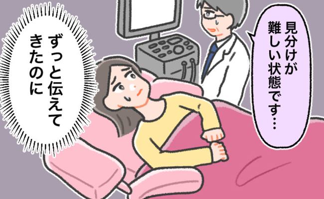 婦人科系の病気の診察　イメージカット